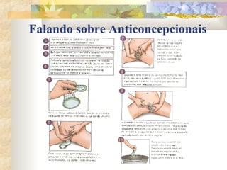 Falando sobre Anticoncepcionais 