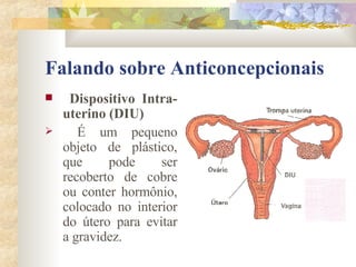 Falando sobre Anticoncepcionais Dispositivo Intra-uterino (DIU) É um pequeno objeto de plástico, que pode ser recoberto de cobre ou conter hormônio, colocado no interior do útero para evitar a gravidez. 