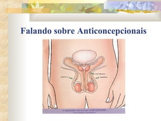 Falando sobre Anticoncepcionais 