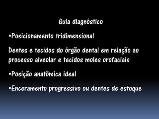 Guia diagnóstico
•Posicionamento tridimensional
Dentes e tecidos do órgão dental em relação ao
processo alveolar e tecidos moles orofaciais
•Posição anatômica ideal
•Enceramento progressivo ou dentes de estoque
 