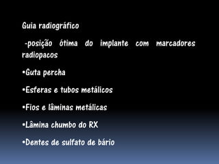 Guia radiográfico
 -posição ótima do implante com marcadores
radiopacos
•Guta percha
•Esferas e tubos metálicos
•Fios e lâminas metálicas
•Lâmina chumbo do RX
•Dentes de sulfato de bário
 