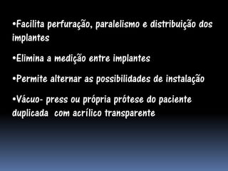 •Facilita perfuração, paralelismo e distribuição dos
implantes
•Elimina a medição entre implantes
•Permite alternar as possibilidades de instalação
•Vácuo- press ou própria prótese do paciente
duplicada com acrílico transparente
 