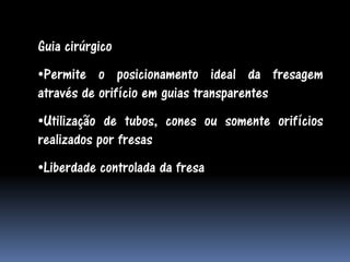 Guia cirúrgico
•Permite o posicionamento ideal da fresagem
através de orifício em guias transparentes
•Utilização de tubos, cones ou somente orifícios
realizados por fresas
•Liberdade controlada da fresa
 