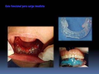 Guia funcional para carga imediata
 