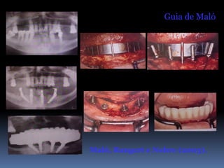 Guia de Maló




Maló, Rangert e Nobre (2003).
 