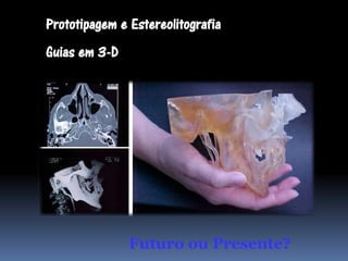 Prototipagem e Estereolitografia
Guias em 3-D




               Futuro ou Presente?
 