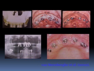 van Steenberghe et al. (2002).
 