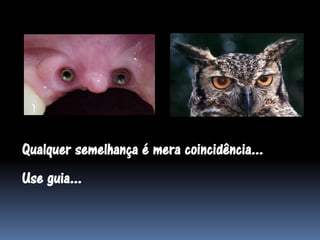 Qualquer semelhança é mera coincidência...
Use guia...
 