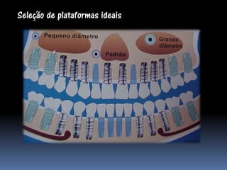 Seleção de plataformas ideais
 