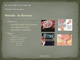 Objetivo:  Impedir progressão gametas masculinos no trato reprodutivo feminino Tipos: Diafragma Esponjas e Espermicidas DIU (sem hormônios) Codom ou preservativo Masculino Feminino Chirlei A Ferreira 