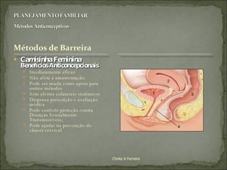 Camisinha Feminina  Benefícios Anticoncepcionais Imediatamente eficaz Não afeta a amamentação Pode ser usada como apoio para outros métodos Sem efeitos colaterais sistêmicos Dispensa prescrição e avaliação médica Pode conferir proteção contra Doenças Sexualmente Transmissíveis;  Pode ajudar na prevenção do  câncer cervical Chirlei A Ferreira 