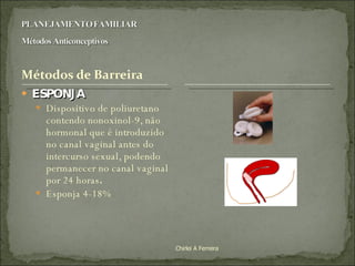 ESPONJA Dispositivo de poliuretano contendo nonoxinol-9, não hormonal que é introduzido no canal vaginal antes do intercurso sexual, podendo permanecer no canal vaginal por 24 horas . Esponja 4-18% Chirlei A Ferreira 