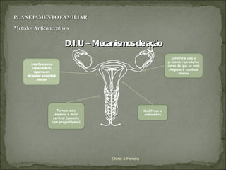 D.I.U – Mecanismos de ação Chirlei A Ferreira Interfere com o processo reprodutivo antes de que os ovos cheguem à cavidade uterina Tornam mais espesso o muco cervical (somente com progestágeno) Modificam o endométrio Interfere com a capacidade do esperma em atravessar a cavidade uterina 