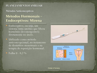 Endoceptivo, ou seja, um sistema intra-uterino que libera hormônio (levonorgestrel) diretamente no útero.  Utilizado como método anticoncepcional, no tratamento de distúrbios menstruais e na terapia de reposição hormonal.  Falha 0 - 0,2 % Chirlei A Ferreira 