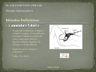 Laqueadura Tubária Requer procedimento cirúrgico, simples e seguro. A esterilização feminina é também conhecida como laqueadura tubária, ligadura tubária, ligadura de trompas, oclusão tubária Anticoncepção cirúrgica voluntária Falha:  0,1-0,4% Chirlei A Ferreira 