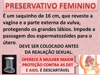 OFERECE À MULHER MAIOR PROTEÇÃO CONTRA AS DST E AIDS.  É DESCARTÁVEL É um saquinho de 16 cm, que reveste a vagina e a parte externa da vulva, protegendo os grandes lábios. Impede a passagem dos espermatozóides para o útero . DEVE SER COLOCADO ANTES DA REALAÇÃO SEXUAL. 