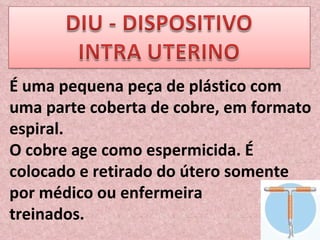 É uma pequena peça de plástico com uma parte coberta de cobre, em formato espiral. O cobre age como espermicida. É colocado e retirado do útero somente por médico ou enfermeira  treinados. 