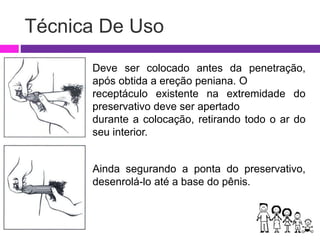 Técnica De Uso
Deve ser colocado antes da penetração,
após obtida a ereção peniana. O
receptáculo existente na extremidade do
preservativo deve ser apertado
durante a colocação, retirando todo o ar do
seu interior.
Ainda segurando a ponta do preservativo,
desenrolá-lo até a base do pênis.
 