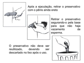 Após a ejaculação, retirar o preservativo
com o pênis ainda ereto
Retirar o preservativo
segurando-o pela base
para que não haja
vazamento de
esperma.
O preservativo não deve ser
reutilizado, devendo ser
descartado no lixo após o uso.
 