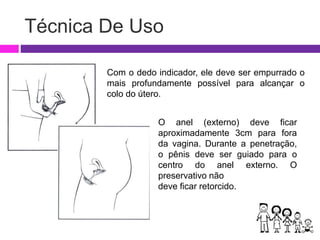 Técnica De Uso
Com o dedo indicador, ele deve ser empurrado o
mais profundamente possível para alcançar o
colo do útero.
O anel (externo) deve ficar
aproximadamente 3cm para fora
da vagina. Durante a penetração,
o pênis deve ser guiado para o
centro do anel externo. O
preservativo não
deve ficar retorcido.
 