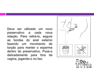 Deve ser utilizado um novo
preservativo a cada nova
relação. Para retirá-lo, segure
as bordas do anel externo
fazendo um movimento de
torção para manter o esperma
dentro do preservativo. Puxe-o
delicadamente para fora da
vagina, jogando-o no lixo.
 
