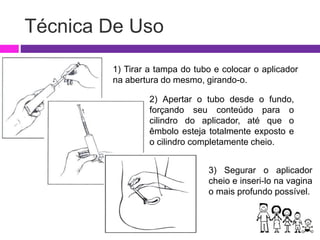 Técnica De Uso
1) Tirar a tampa do tubo e colocar o aplicador
na abertura do mesmo, girando-o.
2) Apertar o tubo desde o fundo,
forçando seu conteúdo para o
cilindro do aplicador, até que o
êmbolo esteja totalmente exposto e
o cilindro completamente cheio.
3) Segurar o aplicador
cheio e inseri-lo na vagina
o mais profundo possível.
 
