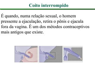 Coito interrompido
É quando, numa relação sexual, o homem
pressente a ejaculação, retira o pênis e ejacula
fora da vagina. É um dos métodos contraceptivos
mais antigos que existe.
 