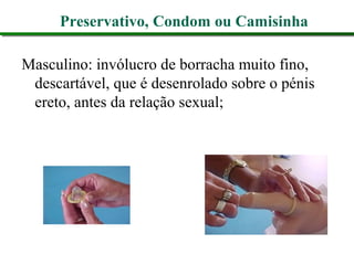 Preservativo, Condom ou Camisinha
Masculino: invólucro de borracha muito fino,
descartável, que é desenrolado sobre o pénis
ereto, antes da relação sexual;
 