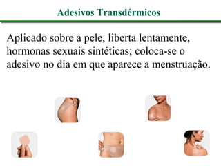 Adesivos Transdérmicos
Aplicado sobre a pele, liberta lentamente,
hormonas sexuais sintéticas; coloca-se o
adesivo no dia em que aparece a menstruação.
 