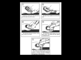 Planejamento noivos1