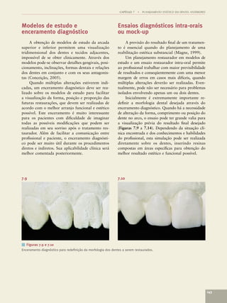 CAPÍTULO 7   •   PLANEJAMENTO ESTÉTICO EM DENTES ANTERIORES



Modelos de estudo e                                           Ensaios diagnósticos intra-orais
enceramento diagnóstico                                       ou mock-up
     A obtenção de modelos de estudo da arcada                     A previsão do resultado ﬁnal de um tratamen-
superior e inferior permitem uma visualização                 to é essencial quando do planejamento de uma
tridimensional dos dentes e tecidos adjacentes,               reabilitação estética substancial (Magne, 1999).
impossível de se obter clinicamente. Através dos                   Um planejamento restaurador em modelos de
modelos pode-se observar detalhes gengivais, posi-            estudo e um ensaio restaurador intra-oral permite
cionamento, inclinações, formas dentais e relações            ao proﬁssional trabalhar com maior previsibilidade
dos dentes em conjunto e com os seus antagonis-               de resultados e conseqüentemente com uma menor
tas (Conceição, 2005).                                        margem de erros em casos mais difíceis, quando
     Quando múltiplas alterações estiverem indi-              múltiplas alterações deverão ser realizadas. Even-
cadas, um enceramento diagnóstico deve ser rea-               tualmente, pode não ser necessário para problemas
lizado sobre os modelos de estudo para facilitar              isolados envolvendo apenas um ou dois dentes.
a visualização da forma, posição e proporção das                   Inicialmente é extremamente importante re-
futuras restaurações, que devem ser realizadas de             deﬁnir a morfologia dental desejada através do
acordo com o melhor arranjo funcional e estético              enceramento diagnóstico. Quando há a necessidade
possível. Este enceramento é muito interessante               de alteração da forma, comprimento ou posição do
para os pacientes com diﬁculdade de imaginar                  dente no arco, o ensaio pode ter grande valia para
todas as possíveis modiﬁcações que podem ser                  a visualização prévia do resultado ﬁnal desejado
realizadas em seu sorriso após o tratamento res-              (Figuras 7.9 a 7.14). Dependendo da situação clí-
taurador. Além de facilitar a comunicação entre               nica encontrada e dos conhecimentos e habilidades
proﬁssional e paciente, o enceramento diagnósti-              do proﬁssional, esta simulação pode ser realizada
co pode ser muito útil durante os procedimentos               diretamente sobre os dentes, inserindo resinas
diretos e indiretos. Sua aplicabilidade clínica será          compostas em áreas especíﬁcas para obtenção do
melhor comentada posteriormente.                              melhor resultado estético e funcional possível.




7.9                                                           7.10




■ Figuras 7.9 e 7.10
Enceramento diagnóstico para redeﬁnição da morfologia dos dentes a serem restaurados.




                                                                                                                             143
 