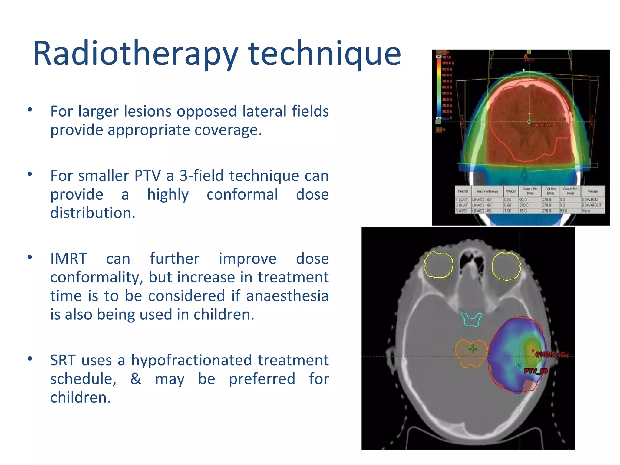 Radiotherapy plan evaluation in brain tumours | PPT