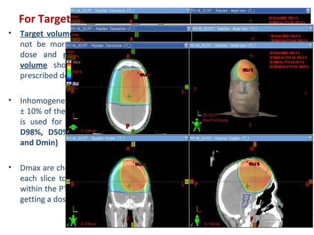 Brain Radiotherapy Shell Radiotherapy plan evaluation in brain tumours | PPT | Brain and Nervous ...