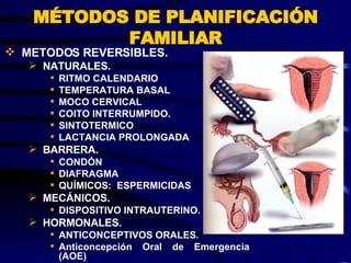 MÉTODOS DE PLANIFICACIÓN FAMILIAR METODOS REVERSIBLES. NATURALES. RITMO CALENDARIO TEMPERATURA BASAL MOCO CERVICAL COITO INTERRUMPIDO. SINTOTERMICO LACTANCIA PROLONGADA BARRERA. CONDÓN DIAFRAGMA QUÍMICOS:  ESPERMICIDAS MECÁNICOS. DISPOSITIVO INTRAUTERINO. HORMONALES. ANTICONCEPTIVOS ORALES. Anticoncepción Oral de Emergencia (AOE)  