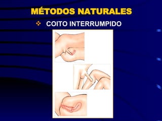 COITO INTERRUMPIDO MÉTODOS NATURALES 