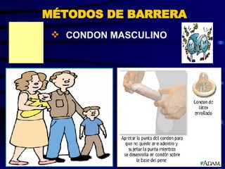 MÉTODOS DE BARRERA CONDON MASCULINO 