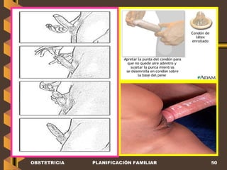 OBSTETRICIA PLANIFICACIÓN FAMILIAR 