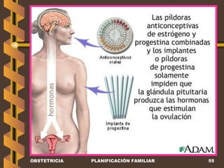 OBSTETRICIA PLANIFICACIÓN FAMILIAR 