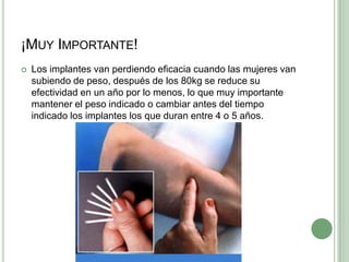 ¡Muy Importante!Los implantes van perdiendo eficacia cuando las mujeres van subiendo de peso, después de los 80kg se reduce su efectividad en un año por lo menos, lo que muy importante mantener el peso indicado o cambiar antes del tiempo indicado los implantes los que duran entre 4 o 5 años.