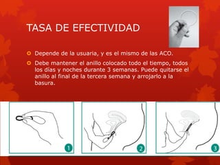 TASA DE EFECTIVIDAD
 Depende de la usuaria, y es el mismo de las ACO.
 Debe mantener el anillo colocado todo el tiempo, todos
los días y noches durante 3 semanas. Puede quitarse el
anillo al final de la tercera semana y arrojarlo a la
basura.
 