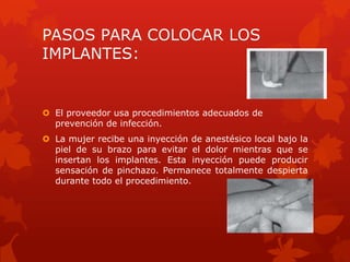 PASOS PARA COLOCAR LOS
IMPLANTES:
 El proveedor usa procedimientos adecuados de
prevención de infección.
 La mujer recibe una inyección de anestésico local bajo la
piel de su brazo para evitar el dolor mientras que se
insertan los implantes. Esta inyección puede producir
sensación de pinchazo. Permanece totalmente despierta
durante todo el procedimiento.
 