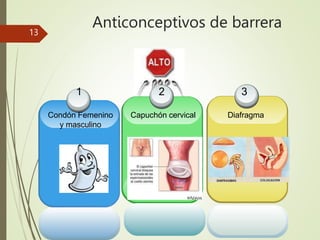 Anticonceptivos de barrera
13
1
Condón Femenino
y masculino
2
Capuchón cervical
3
Diafragma
 