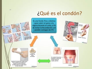 ¿Qué es el condón?
14
 