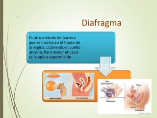 Diafragma
15
 