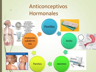 Anticonceptivos
Hormonales
18
 