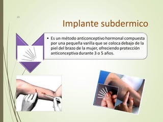 Implante subdermico
20
 