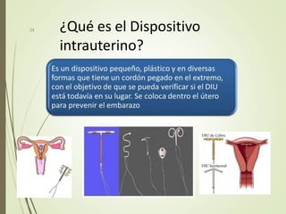¿Qué es el Dispositivo
intrauterino?
24
 