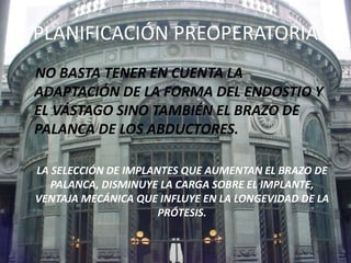 PLANIFICACIÓN PREOPERATORIA 
NO BASTA TENER EN CUENTA LA 
ADAPTACIÓN DE LA FORMA DEL ENDOSTIO Y 
EL VÁSTAGO SINO TAMBIÉN EL BRAZO DE 
PALANCA DE LOS ABDUCTORES. 
LA SELECCIÓN DE IMPLANTES QUE AUMENTAN EL BRAZO DE 
PALANCA, DISMINUYE LA CARGA SOBRE EL IMPLANTE, 
VENTAJA MECÁNICA QUE INFLUYE EN LA LONGEVIDAD DE LA 
PRÓTESIS. 
 