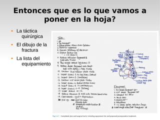 Entonces que es lo que vamos a
poner en la hoja?
 La táctica
quirúrgica
 El dibujo de la
fractura
 La lista del
equipamiento
 