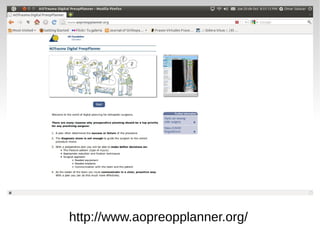 http://www.aopreopplanner.org/
 